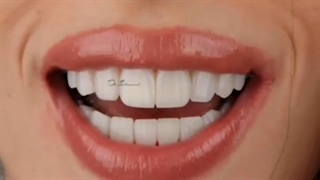 فیلم انجام ونیر کامپوزیت