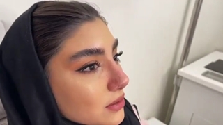 فیلم دو هفته بعد از جراحی بینی