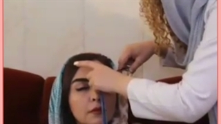 عوامل موثر در ماندگاری کاشت ابرو را بشناسید