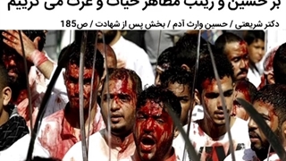 دکتر شریعتی (عزاداری امام حسین) پروتز دندان