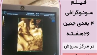 سونوگرافی چهاربعدی