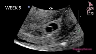 ۹ ماه زندگی جنین در رحم را در یک دقیقه ببینید