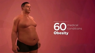 چاقی و ریسک بیمارى هاى کاردیوواسکولار | دکتر یاسمین افسری