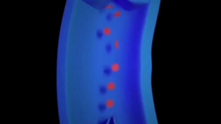 همه چیز درباره واریس | دکتر یاسمین افسری متخصص قلب و عروق