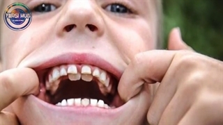 افرادی بسیار یونیک با ویژگی های یک در میلیونی