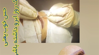 کاشت ابرو با تراکم بالا 09336093000 در گرگان گنبد کردکوی آق قلا
