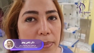 جراحی ترمیمی بینی