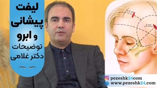 لیفت پیشانی و ابرو برای چه افرادی لازم است؟