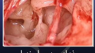 نمای بسیار زیبا از داخل گوش