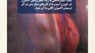 آمبولی ریه چیست؟