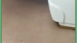 بهترین روش از بین بردن و حذف موهای زاید صورت و بدن خانگی و کلینیکی