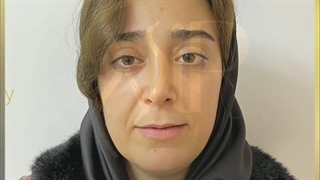 هزینه تزریق ژل لب