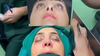 عمل جراحی ترمیمی در خانمی که حدود 20سال قبل