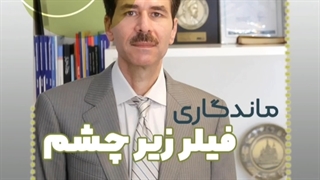 ماندگاری فیلر زیر چشم چقدر است؟