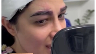 عوارض پاک کردن غیر حرفه ای تتو صورت