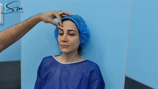 عمل بینی و پلک همزمان