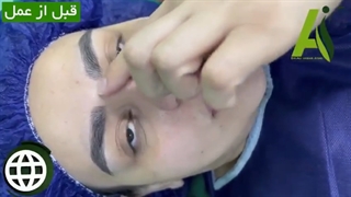 فیلم واقعی از جراحی بینی
