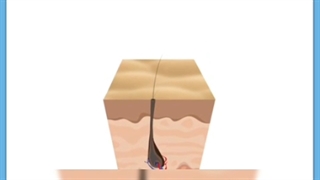 پوست چیست و چگونه از آن محافظت کنیم؟