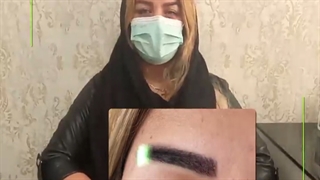 کاشت ابرو حرفه ایی