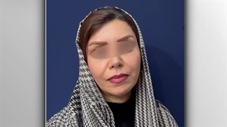 رضایت بیمار عزیز از لیفت آندوسکوپی پیشانی و ابروها | دکتر خوروش