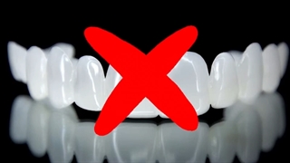 درمان‌های جایگزین اسنپ اسمایل | دکتر داودیان