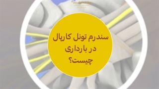 از درمان و علت سندروم تونل کارپال در بارداری چه می دانید