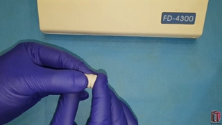 روش کاربرد گلاس آینومر نوری در تکنیک open sandwich