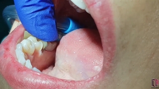 روش کاربرد سکشنال ماتریکس و لوپ