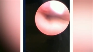 سیالوگرافی