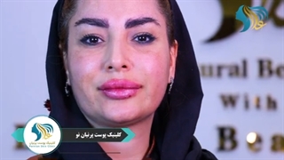 رضایت زیباجو عزیزمون از تزریق فیلر لب