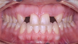 ارتودنسی و ایمپلنت | دکتر داودیان