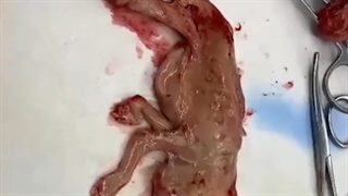 آیهان کوچولوی عزیزم