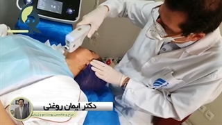 ویدیو انجام هایفوتراپی