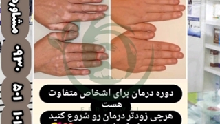 بیماران پوستی ویتیلیگو اینطور درمان میشن پیسی برص vitiligo