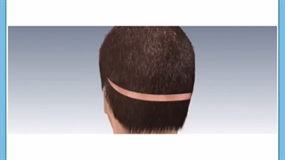 بهترین مرکز کلینیک پزشکی کاشت مو در کرمان کجاست؟