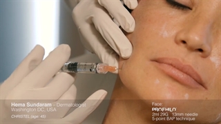 آموزش تزریق پروفایلو