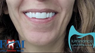 خرید لمینت متحرک دندان دو فک تهران  + قیمت در داروخانه 2024