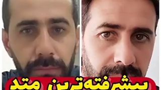 کاشت مو بدون جراحی با پیشرفته ترین متدها