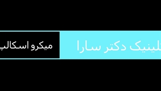 میکرو اسکالپ سر چیست؟