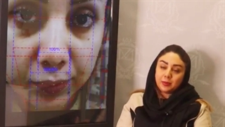 رضایت مراجعه کننده از بهترین مرکز کاشت ابرو