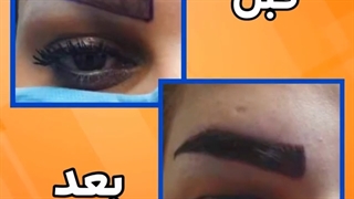 قبل و بعد کاشت ابرو در بهترین مرکز کاشت ابرو