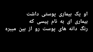 دلیل تغییر رنگ پوست مایکل جکسون چه بود؟