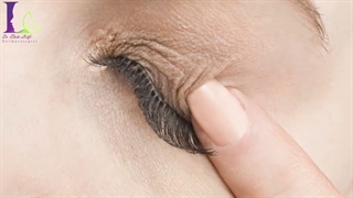 آلرژی های فصلی در بهار