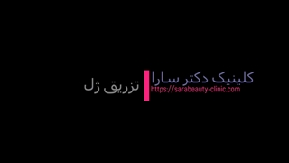 تزریق ژل چگونه انجام میشود؟
