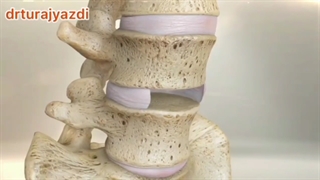 جــراحی ستــون فقــرات