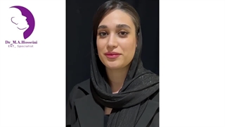 برداشتن گچ و کشیدن بخیه های بینی بعد از عمل | دکتر محمدعلی حسینی