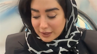 کاشت ابرو بعد از یکسال