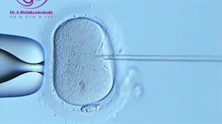 لقاح آزمایشگاهی (IVF) زیر میکروسکوپ