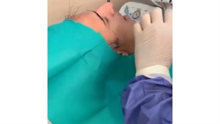 درمان مفاصل فک (درمان آرتروسینتز)