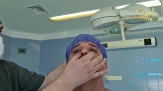 جراحی بینی توسط دکتر تولیت